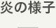 炎の様子